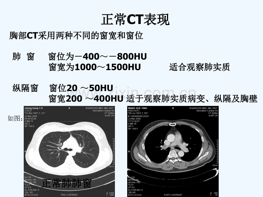 正常胸肺部CT影像学-PPT.ppt_第2页