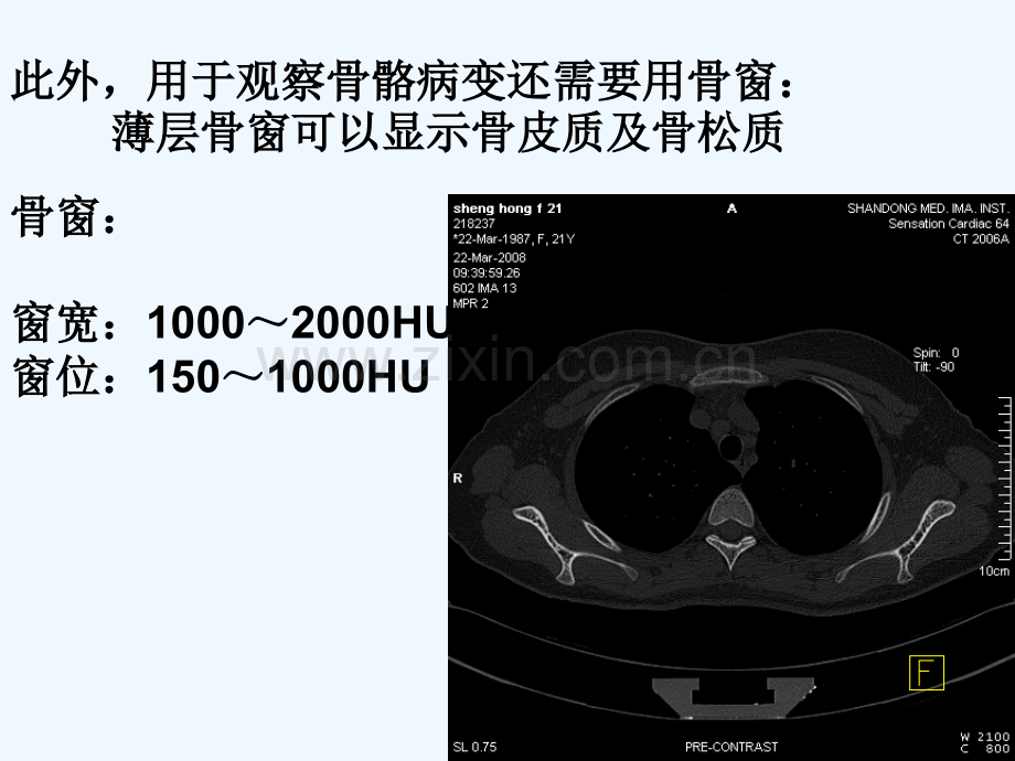 正常胸肺部CT影像学-PPT.ppt_第3页