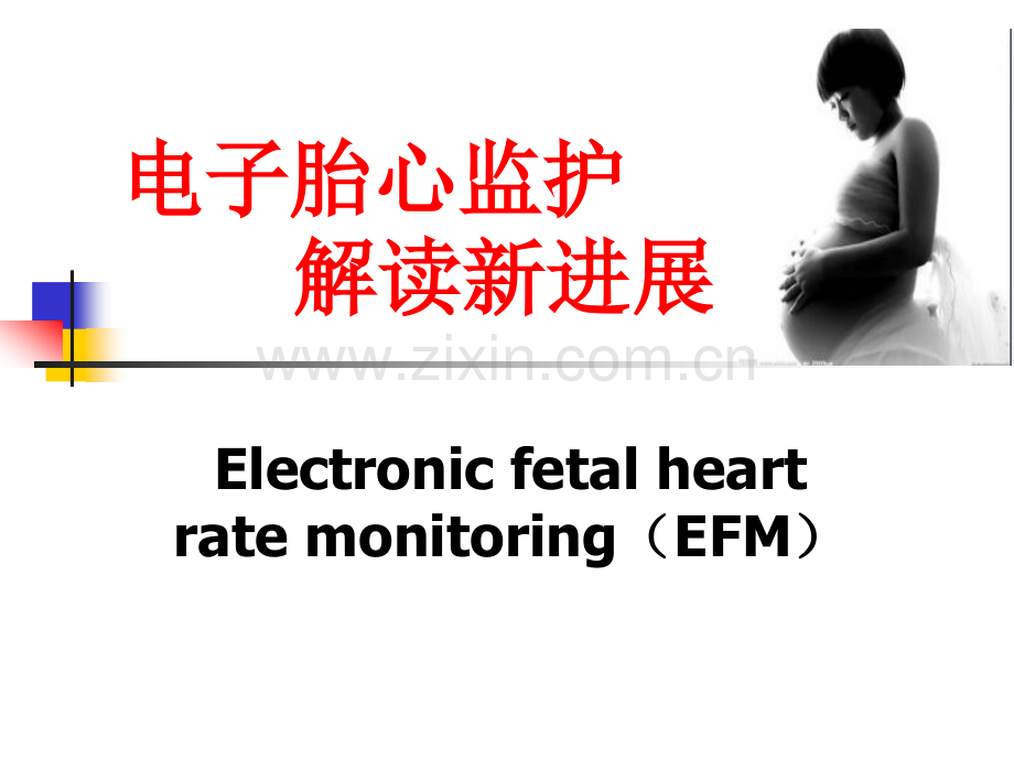 电子胎心监护解读新进展-(1).ppt_第1页