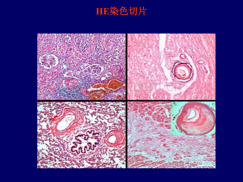 法医学尸体检验切片制作理论与技术.ppt_第2页