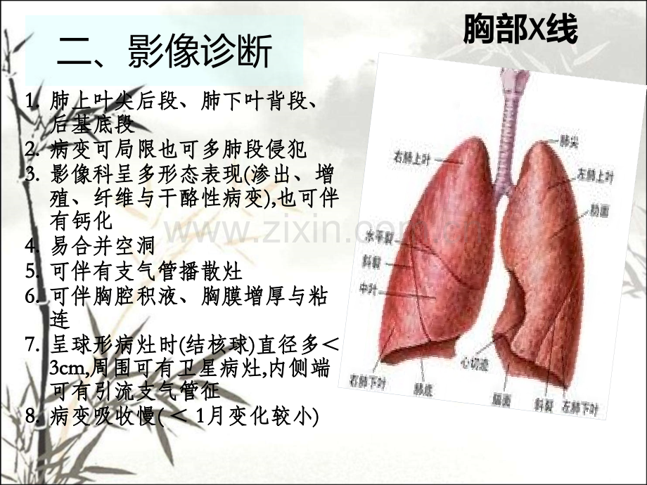 肺结核的临床诊断和治疗.pptx_第3页