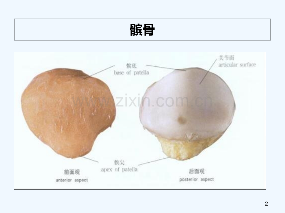 髌骨骨折护理查房-PPT.ppt_第2页