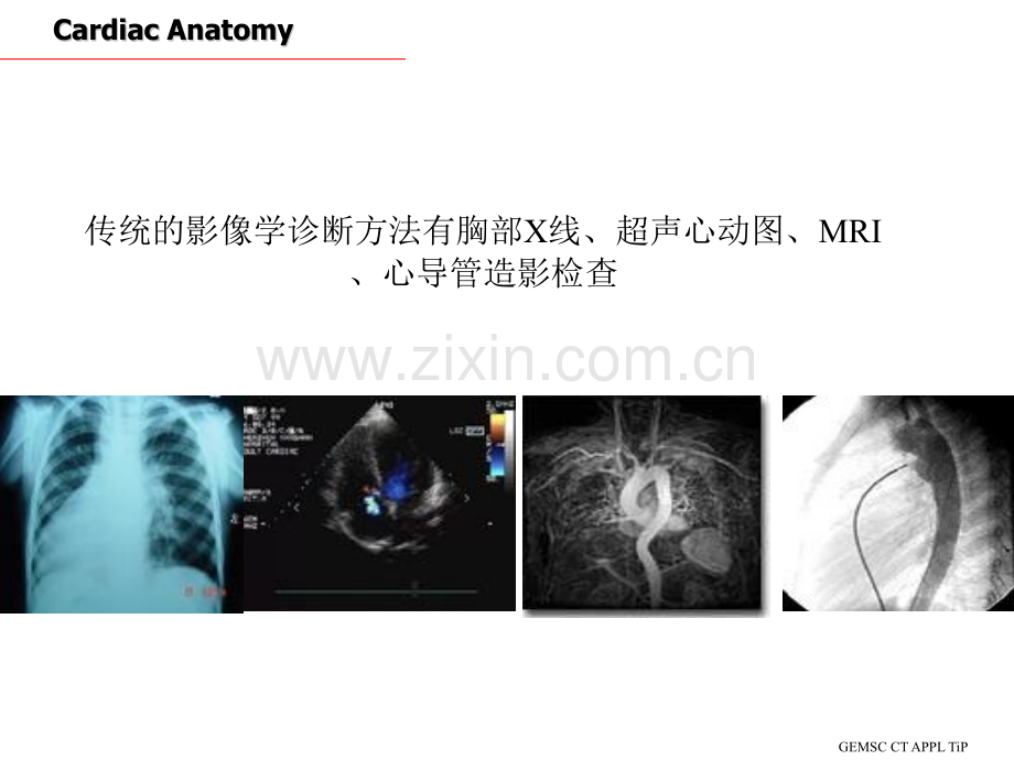 CT心脏断面解剖PPT课件.ppt_第3页