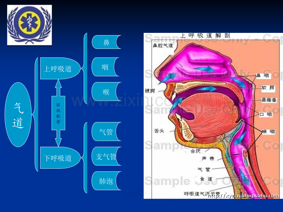 急救气道管理.ppt_第3页