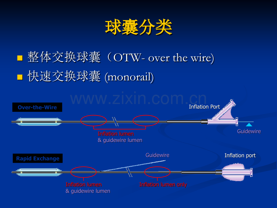 冠状动脉介入治疗的球囊和支架的应用-高展.ppt_第3页