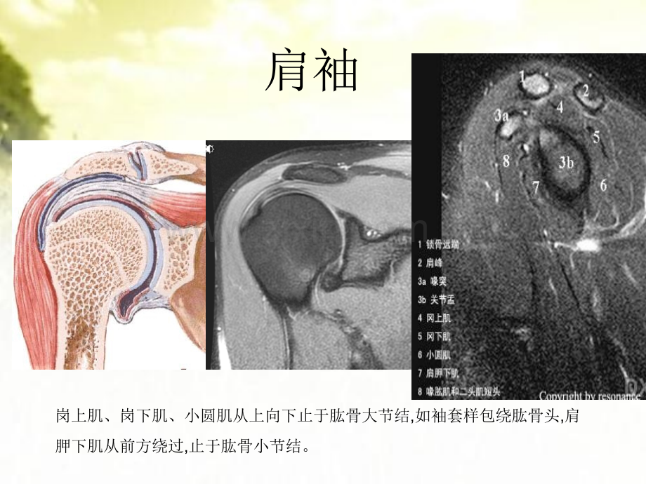 肩关节应用解剖及腱鞘肌腱病的磁共振影像诊断.pptx_第2页