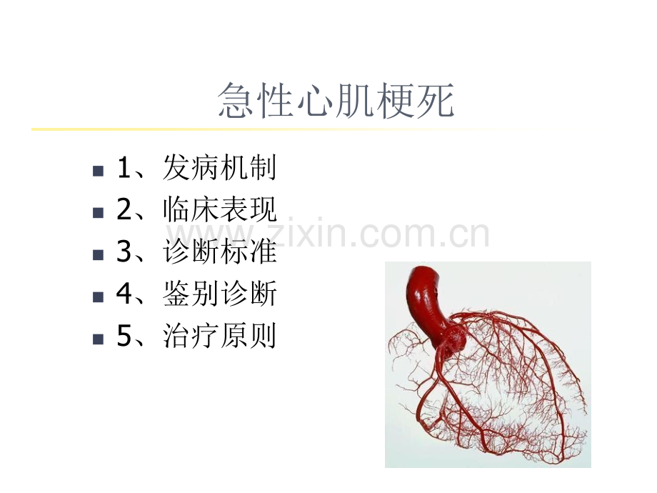 急性心肌梗死的识别.ppt_第2页