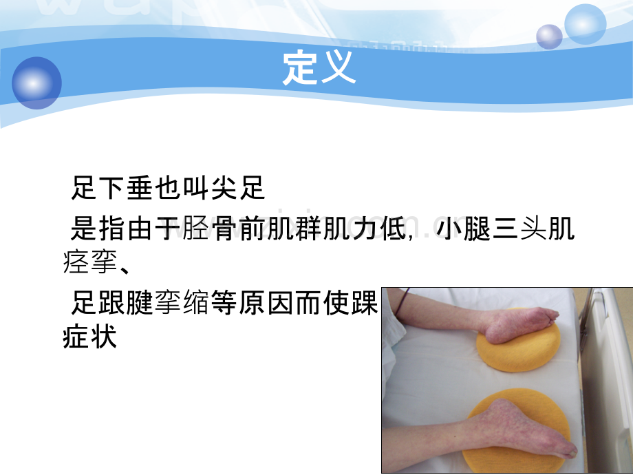 足下垂的预防与护理.ppt_第2页