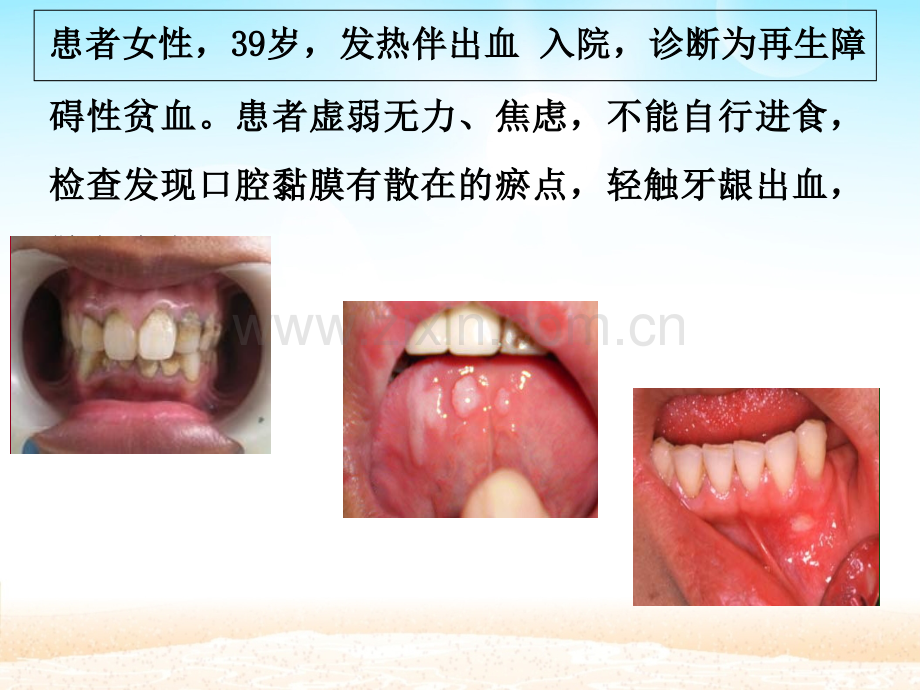 口腔护理及操作.ppt_第2页