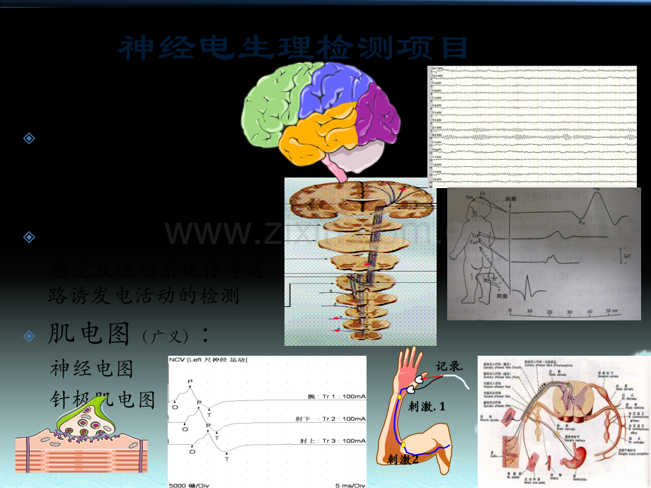 肌电图的检测与应用.pptx_第3页