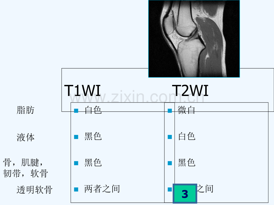 膝关节MRI-PPT.ppt_第3页