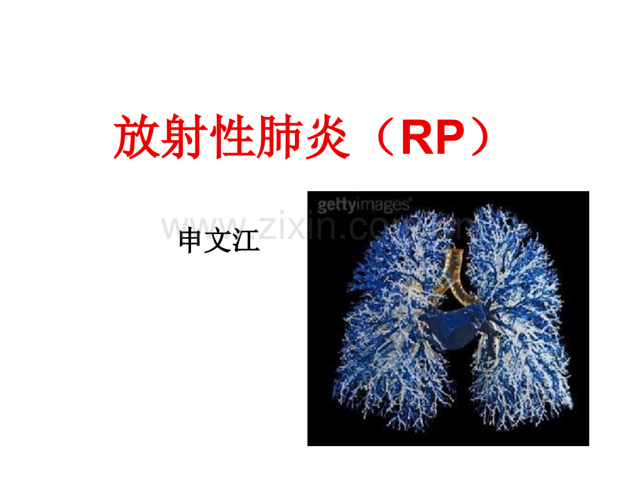 急性放射性肺炎--申文江.ppt_第1页