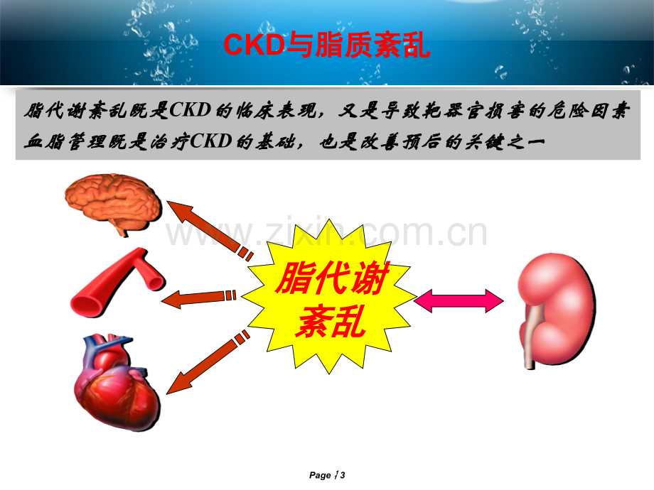 慢性肾脏病的血脂管理.ppt_第3页