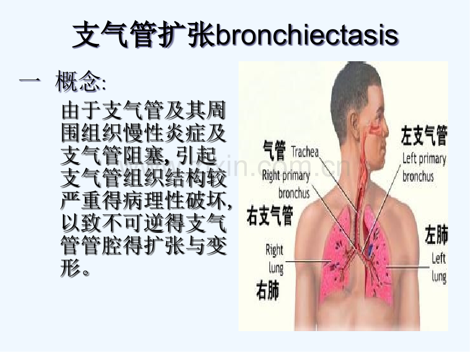 支气管扩张症护理查房ppt.pptx_第2页