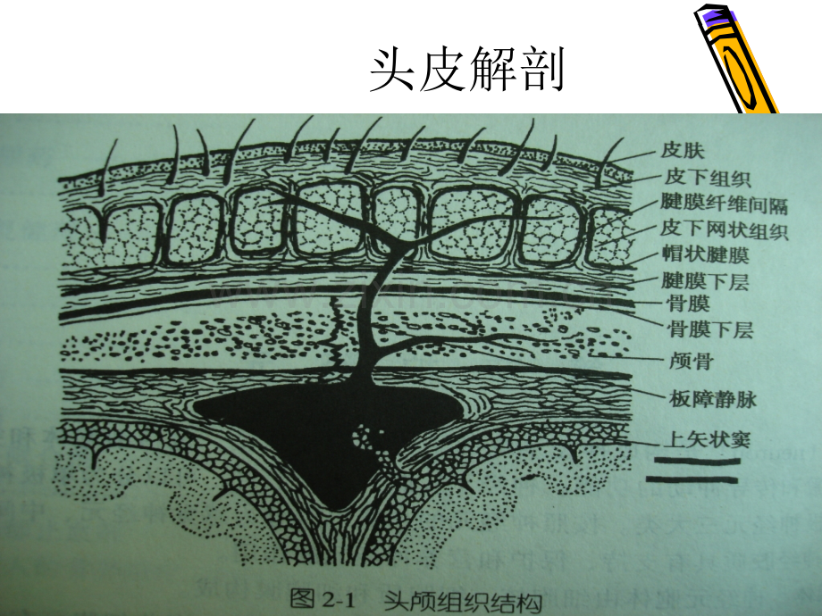 CTMR基本知识.ppt_第1页