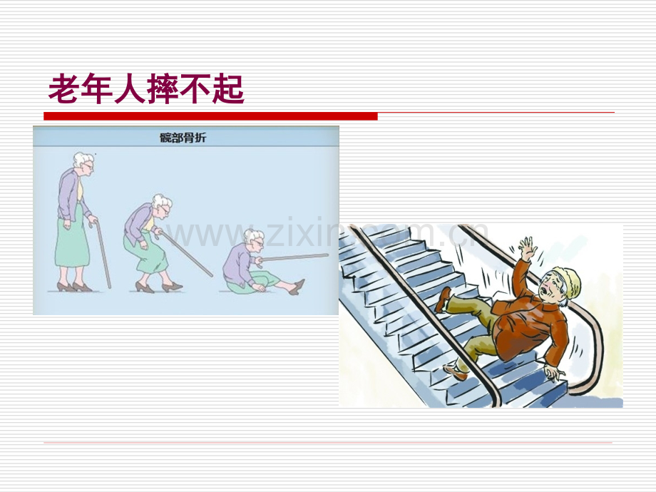 老年髋部骨折.ppt_第2页