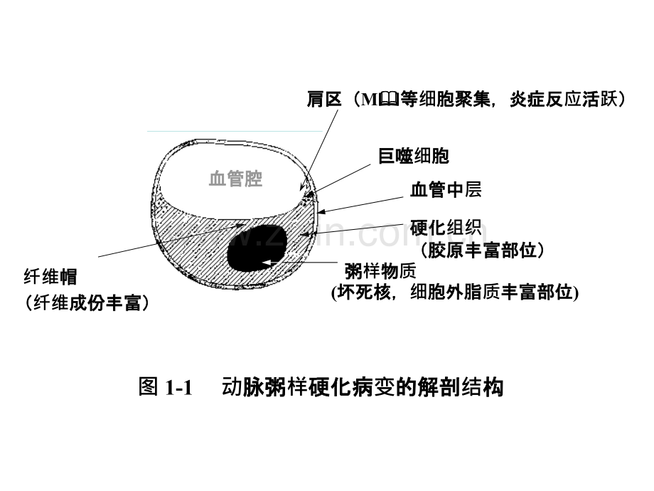 ami早期诊断与防治.pptx_第2页