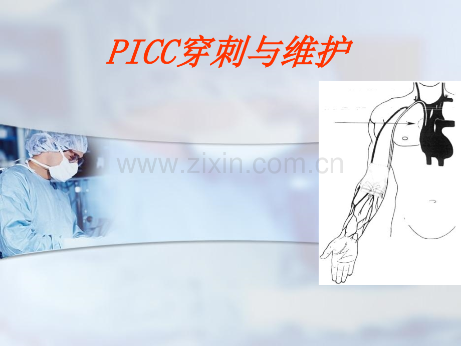 picc穿刺与维护.ppt_第1页