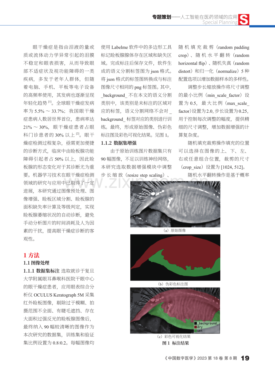 基于DeeplabV3 网络的睑板腺图像分割研究和评价.pdf_第2页