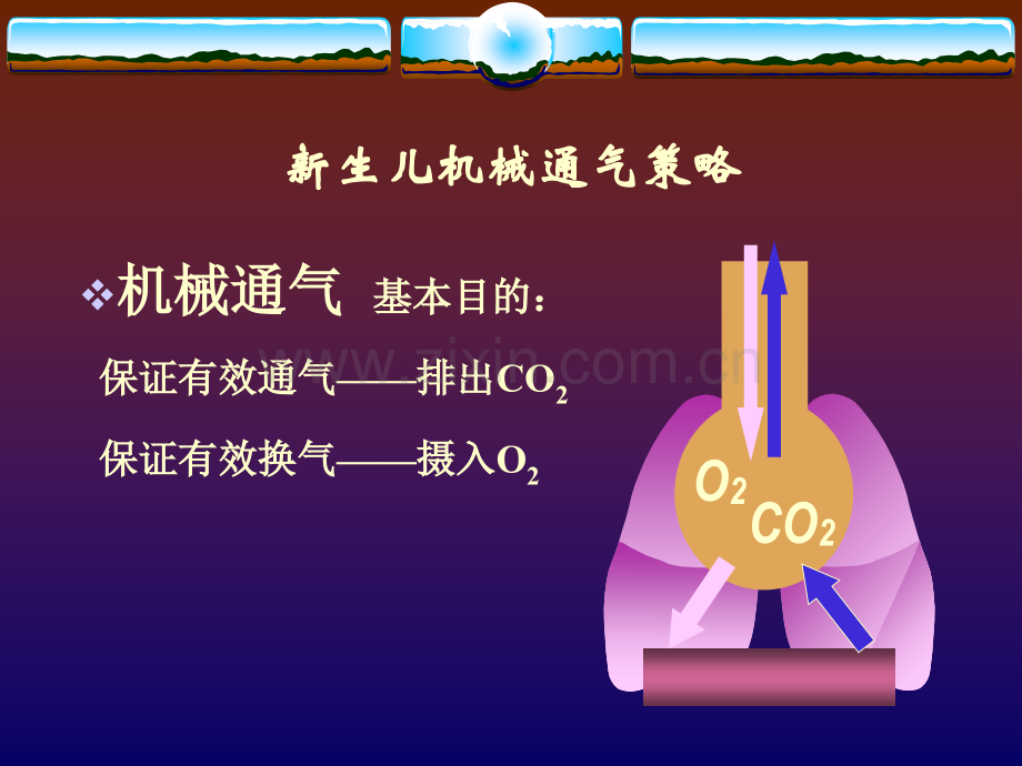 新生儿科SLE-5000呼吸机使用及护理常识课件教学内容.ppt_第2页