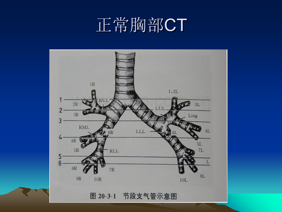 呼吸系统常见病典型胸部CT表现.ppt_第2页