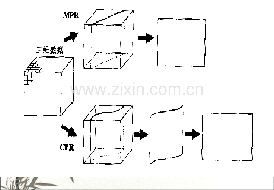 多平面重建(MPR)ppt课件.ppt_第2页