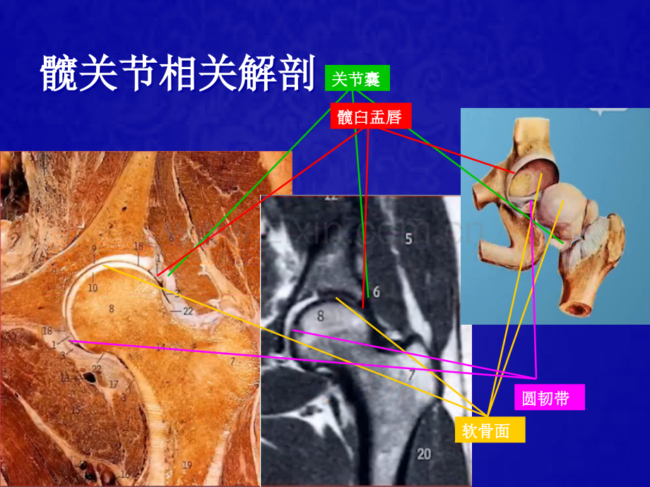 股骨髋臼撞击症的诊断与治疗-PPT.ppt_第2页