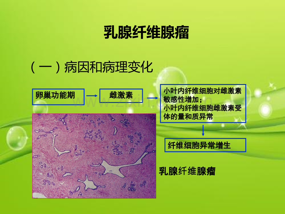 常见乳腺肿瘤的影像表现-PPT.ppt_第3页