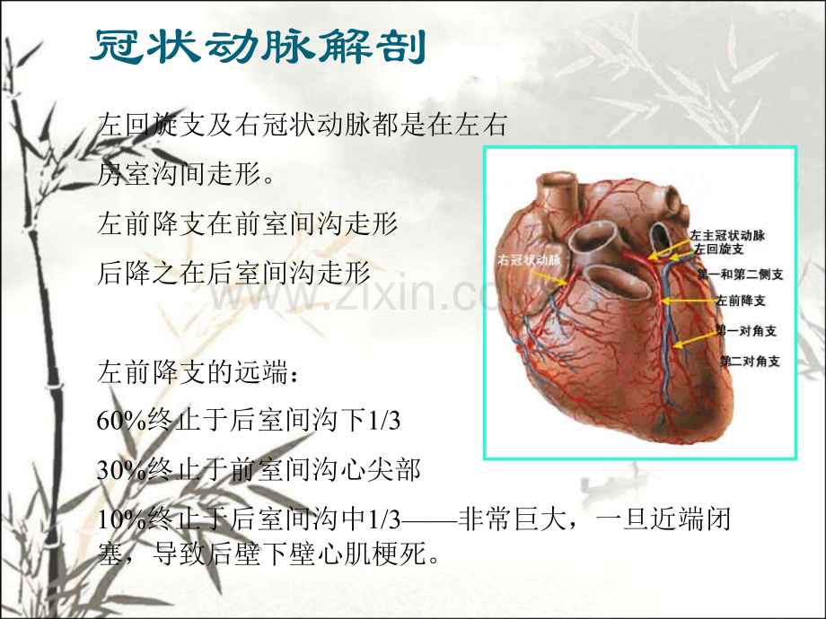 冠状动脉造影识图-PPT.ppt_第3页