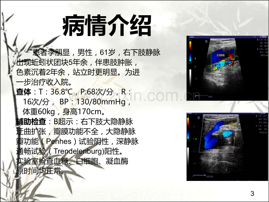 大隐静脉曲张护理查房ppt.ppt_第3页