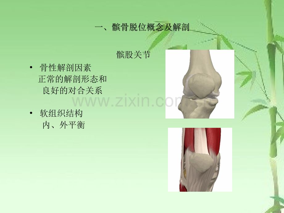 髌骨脱位ppt.ppt_第2页