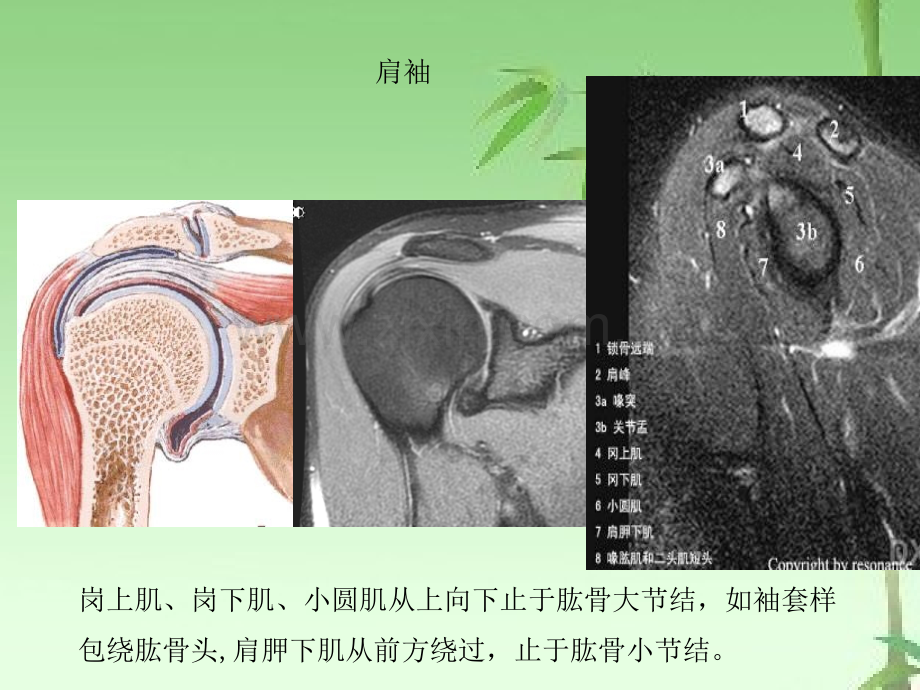 肩关节应用解剖及腱鞘肌腱病的磁共振影像诊断ppt.ppt_第3页