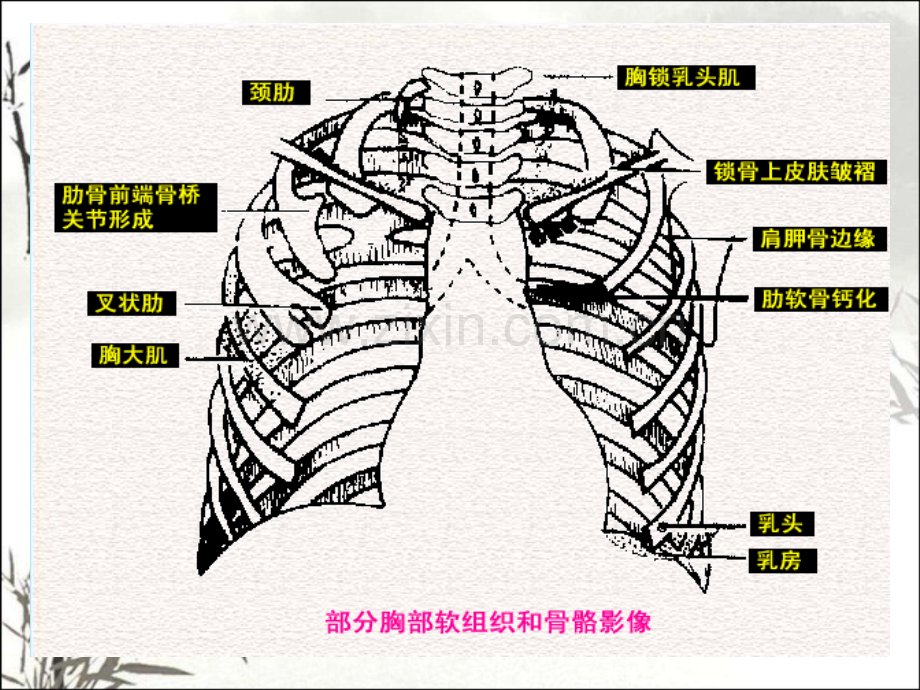 胸片阅读(必看)ppt课件.ppt_第3页