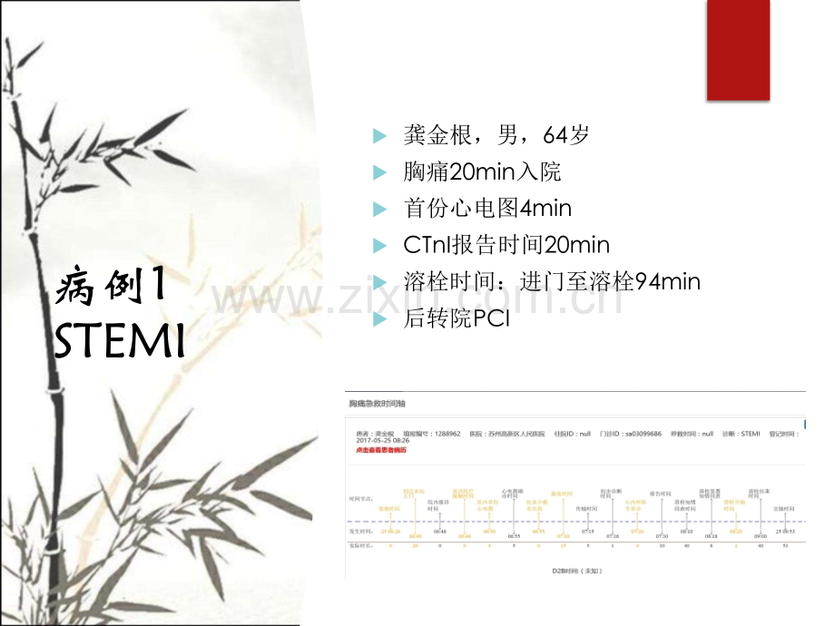 胸痛中心质量分析ppt课件.ppt_第2页