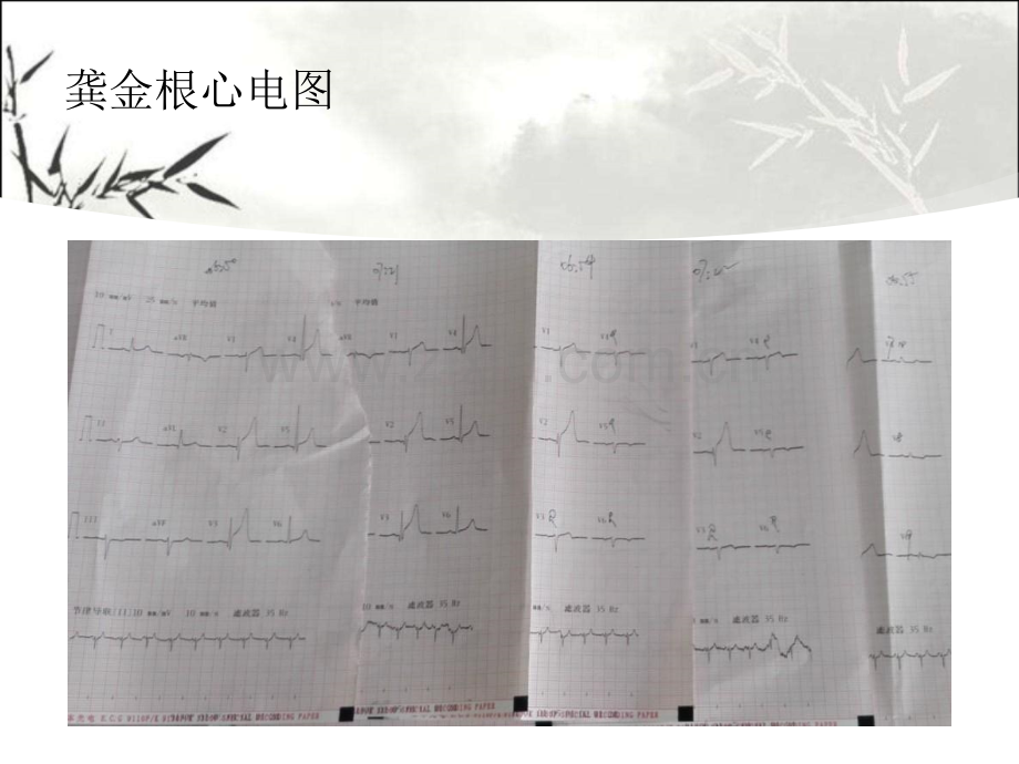 胸痛中心质量分析ppt课件.ppt_第3页