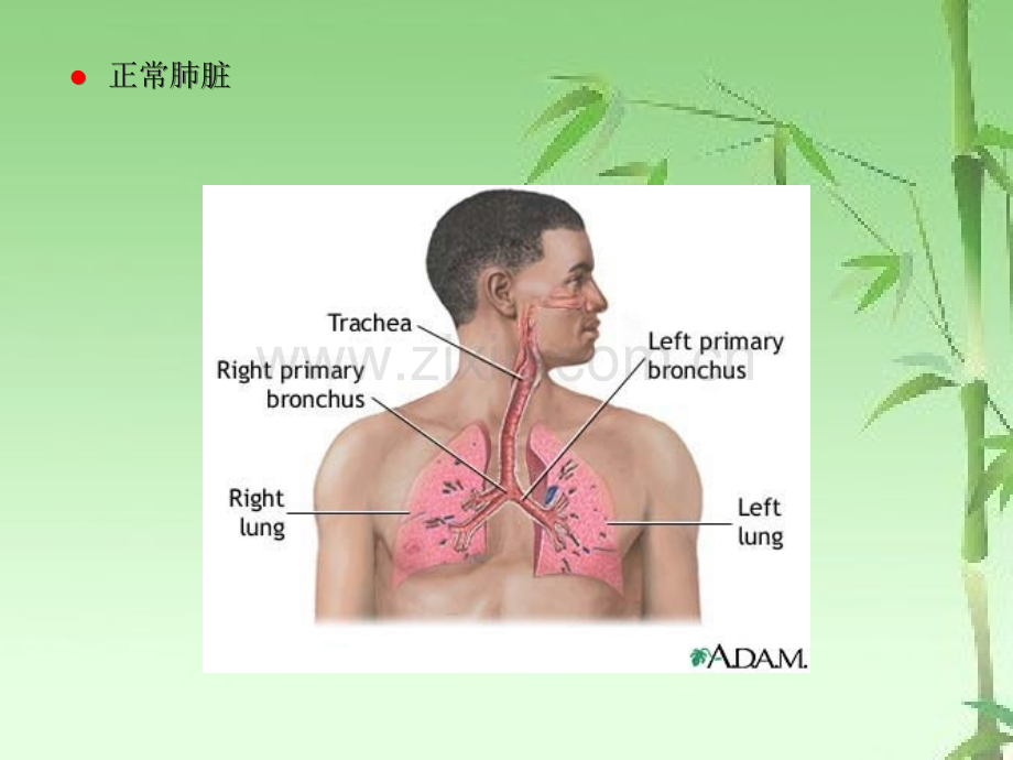 胸腔积液ppt.ppt_第2页