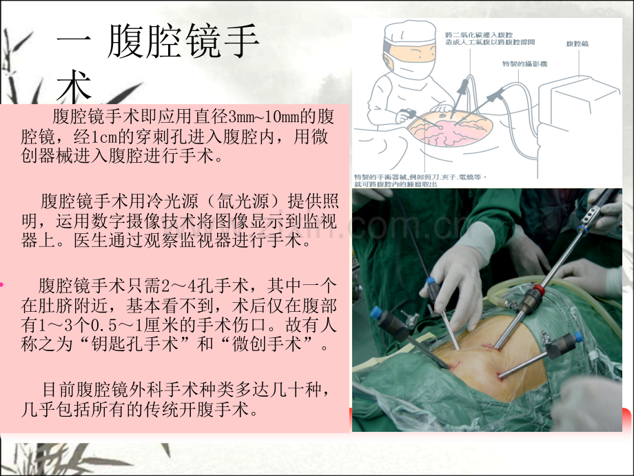 腹腔镜的操作标准ppt课件.ppt_第3页