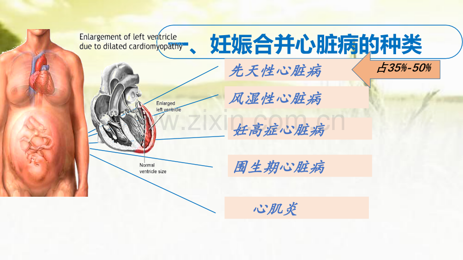 妊娠合并心脏病-PPT.pptx_第3页