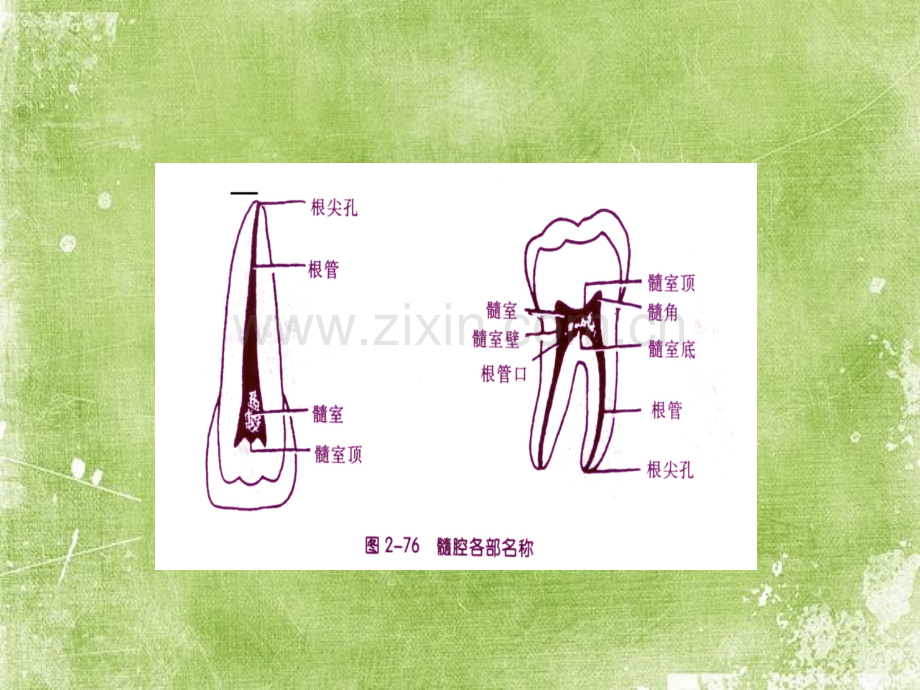 牙体髓腔解剖系统开髓ppt.ppt_第3页