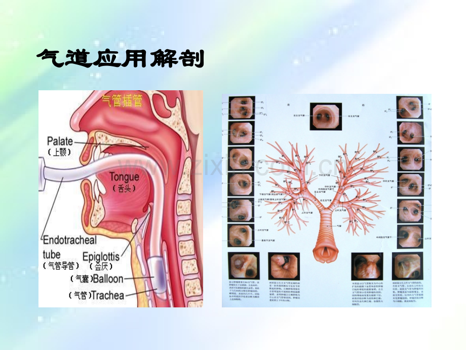 人工气道护理-PPT.ppt_第3页