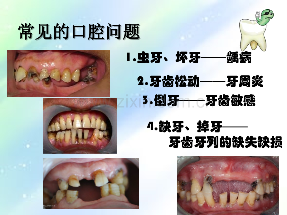 口腔保健与疾病预防-PPT.ppt_第2页