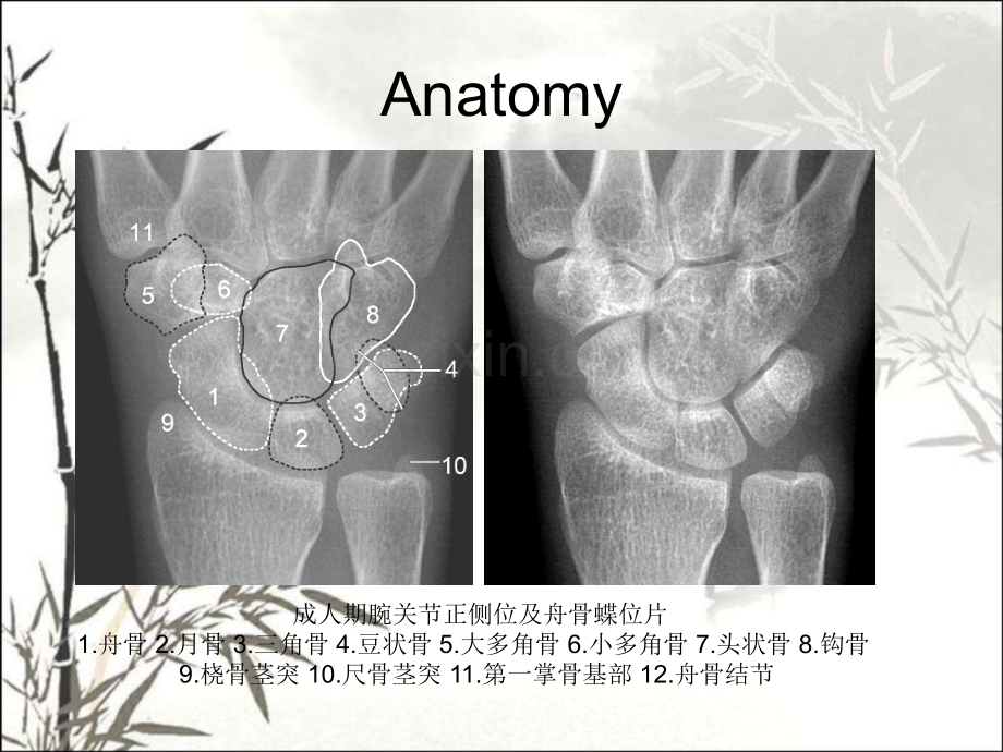 腕关节-X线解剖ppt课件.ppt_第3页