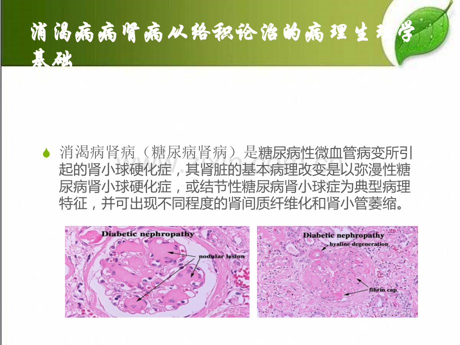 糖尿病肾病从积论治思路-PPT.pptx_第2页