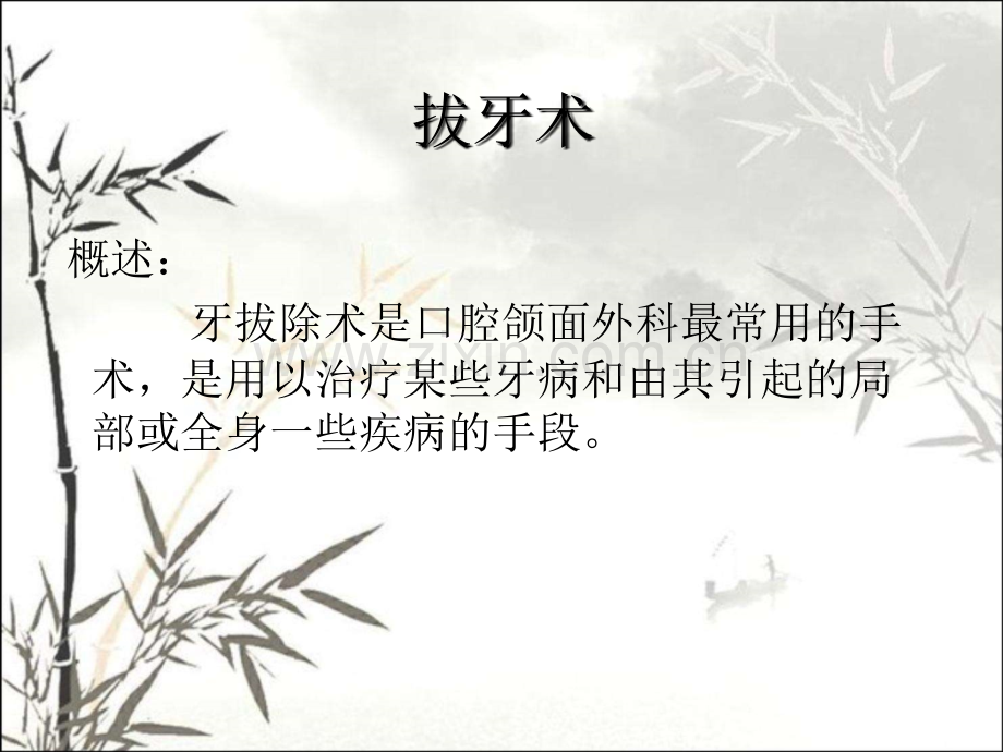 口腔拔牙课件ppt.ppt_第2页