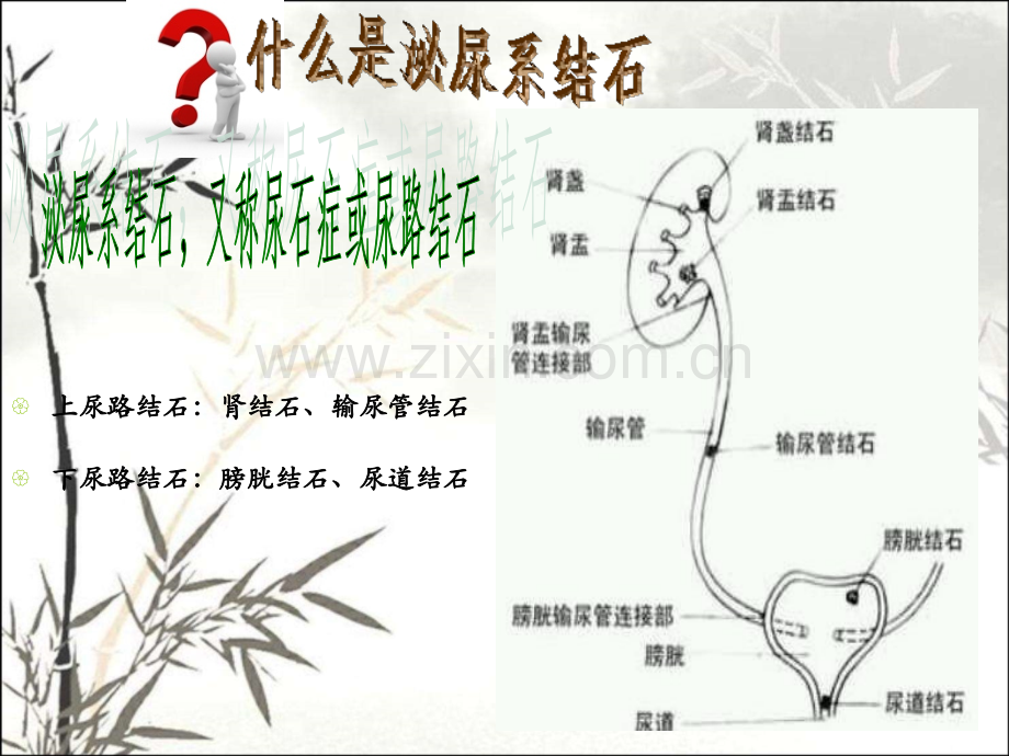 泌尿系结石的健康教育ppt.ppt_第2页