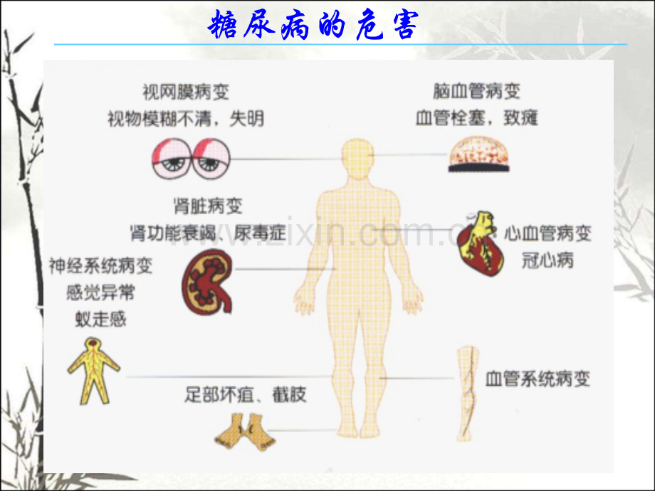 敬老院健康讲座-PPT.ppt_第2页