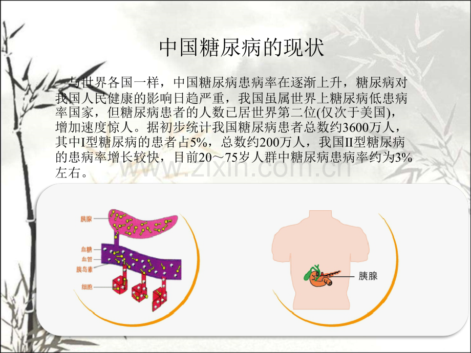 糖尿病课件ppt-(2).ppt_第2页