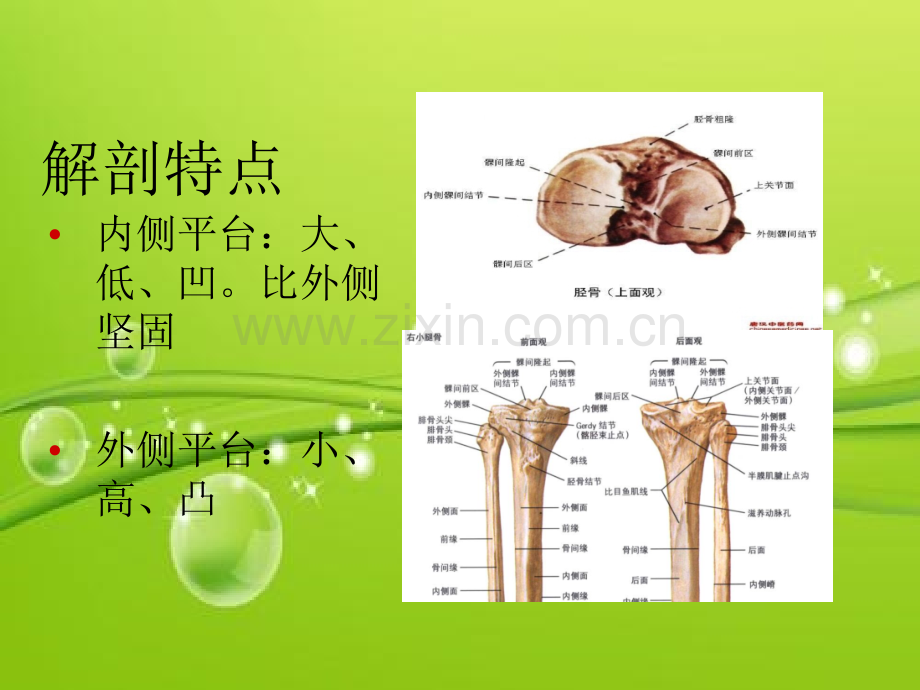 胫骨平台骨折-PPT.ppt_第3页