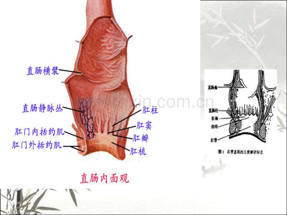 痔疮病人的护理ppt课件.ppt_第3页