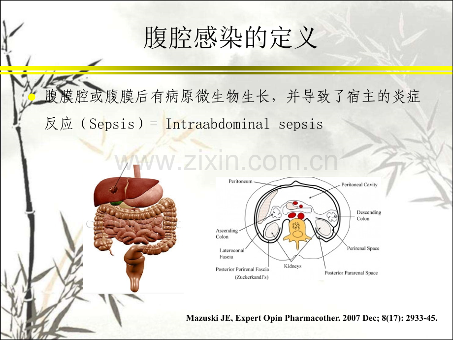 腹腔感染的治疗ppt.ppt_第3页